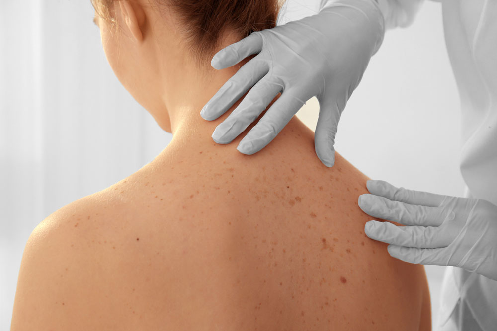 Visita medica specialistica dermatologia